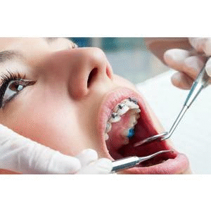 Orthodontic care